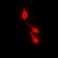 Anti-p38 (pY182) Antibody
